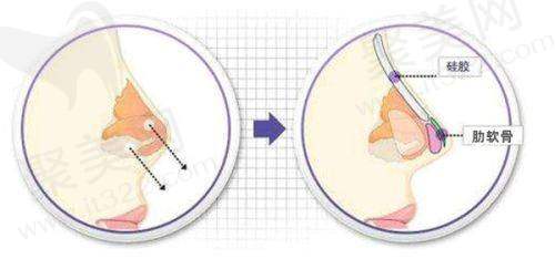 设备助力威海华怡植发良好成效