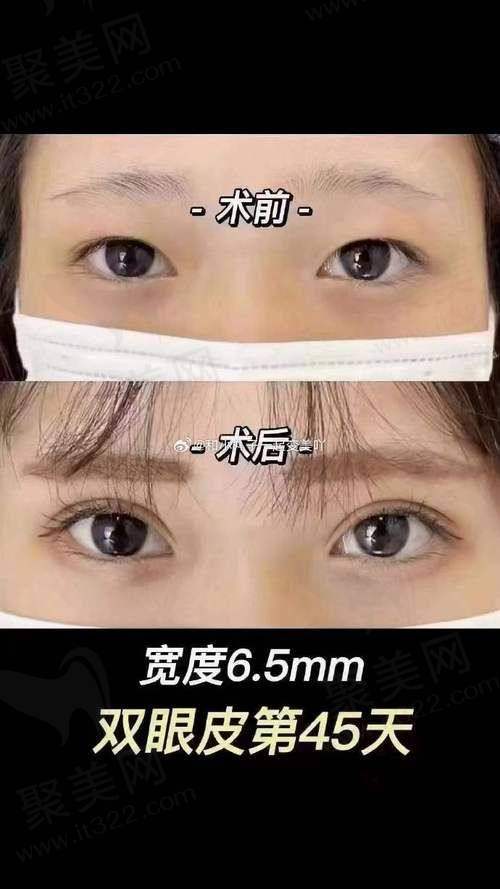 四、太原美媛荟弓军胜医生口碑与评价