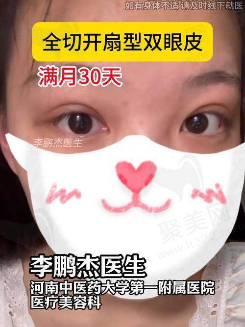 二、美媛荟弓军胜双眼皮做得好吗