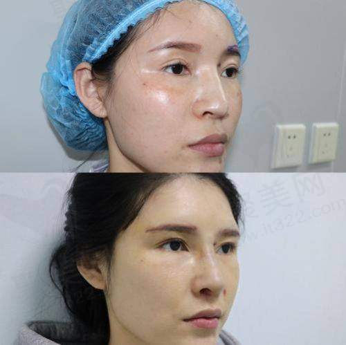 四、南宁华美卢志刚医生口碑体现