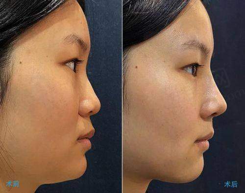 三、南宁华美卢志刚医生技术优势