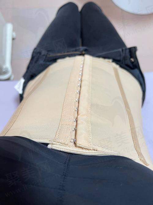 三、广州美莱整形医院——连锁品牌的腰腹环吸保护