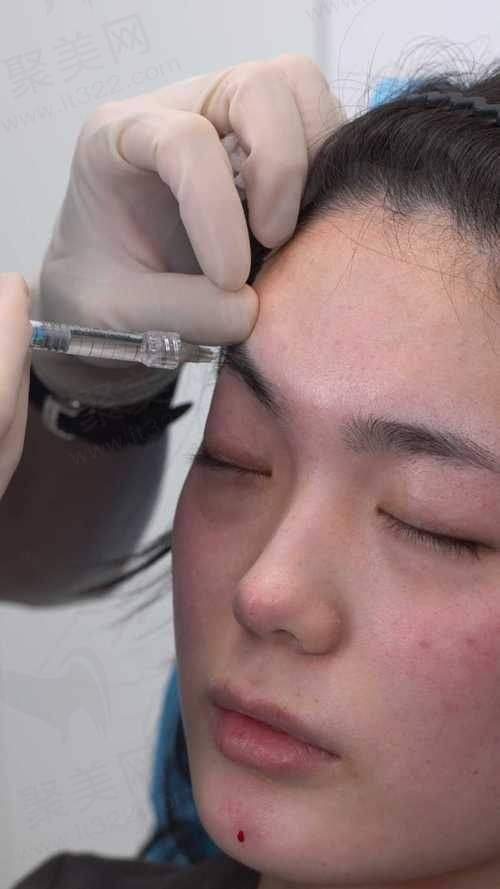 苏州圣爱整形医院注射塑形靠谱吗?价格合理有优势