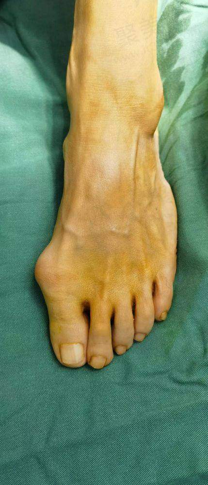 五、费用相关注意事项