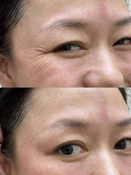 苏州圣爱整形医院注射塑形靠谱吗?精良设施来助力