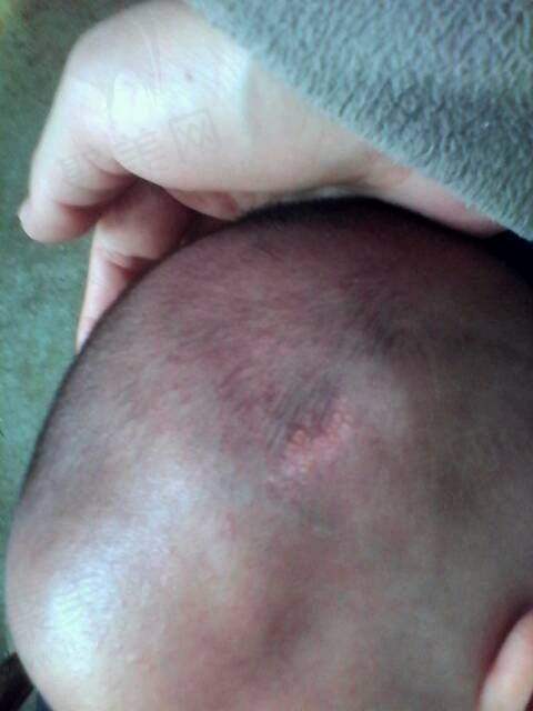 广州荔医医疗美容收费标准参考