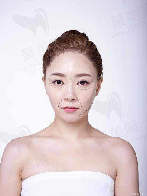 广州荔医医美公主玻尿酸面部轮廓提升原价48000元,折后限时1799元起重塑精致脸型